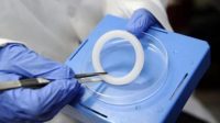 Cincin Vagina Mencegah Penularan Virus HIV / AIDS
