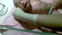 Upaya Pencegahan Bila Perdarahan Tali Pusat Pada Bayi