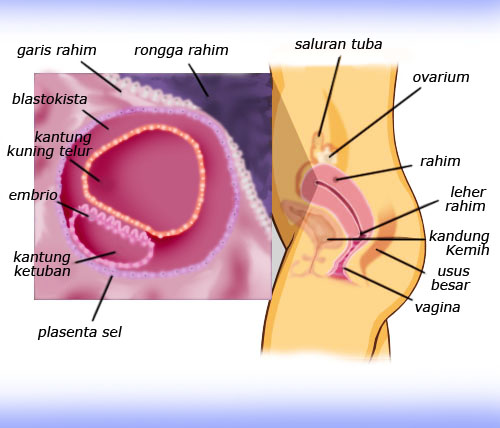 Embrio Blastokista